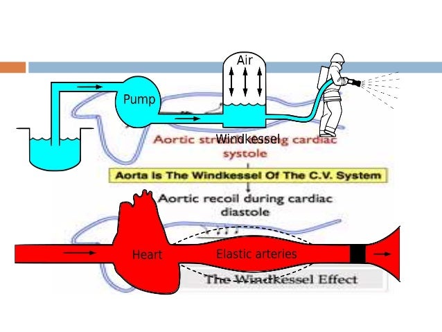 Intra aortic ballon pump