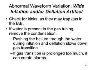 Iab Inflation Intra Aortic Balloon Pump (IABP) 2009.ppt