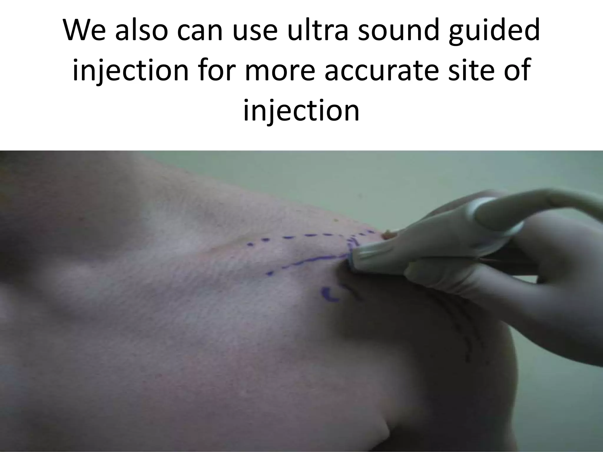 Sound Like Injection Intra articular injection by dr. ahmed shedeed | PPTX