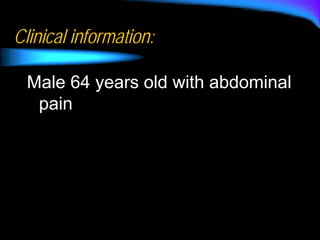Clinical information:

  Male 64 years old with abdominal
   pain
 
