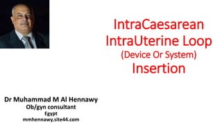 IntraCaesarean
IntraUterine Loop
(Device Or System)
Insertion
Dr Muhammad M Al Hennawy
Ob/gyn consultant
Egypt
mmhennawy.site44.com
 