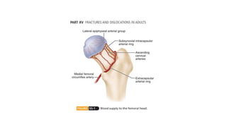 Intracapular Intracapsular fracture neck of femur | PPTX