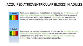ACQUIRED ATRIOVENTRICULAR BLOCKS IN ADULTS
Permanent pacemaker implantation is indicated for third-degree and
advanced second-degree atrioventricular (AV) block at any anatomic
level associated with bradycardia with symptoms (including heart
failure) or ventricular arrhythmias presumed to be due to AV block.
Permanent pacemaker implantation is indicated for third-degree and
advanced second-degree AV block at any anatomic level associated
with arrhythmias and other medical conditions that require drug
therapy that results in symptomatic bradycardia.
 