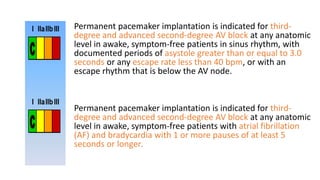 Permanent pacemaker implantation is indicated for third-
degree and advanced second-degree AV block at any anatomic
level in awake, symptom-free patients in sinus rhythm, with
documented periods of asystole greater than or equal to 3.0
seconds or any escape rate less than 40 bpm, or with an
escape rhythm that is below the AV node.
Permanent pacemaker implantation is indicated for third-
degree and advanced second-degree AV block at any anatomic
level in awake, symptom-free patients with atrial fibrillation
(AF) and bradycardia with 1 or more pauses of at least 5
seconds or longer.
 