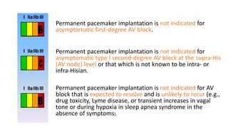 Permanent pacemaker implantation is not indicated for
asymptomatic first-degree AV block.
Permanent pacemaker implantation is not indicated for
asymptomatic type I second-degree AV block at the supra-His
(AV node) level or that which is not known to be intra- or
infra-Hisian.
Permanent pacemaker implantation is not indicated for AV
block that is expected to resolve and is unlikely to recur (e.g.,
drug toxicity, Lyme disease, or transient increases in vagal
tone or during hypoxia in sleep apnea syndrome in the
absence of symptoms).
 