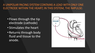 A UNIPOLAR PACING SYSTEM CONTAINS A LEAD WITH ONLY ONE
ELECTRODE WITHIN THE HEART; IN THIS SYSTEM, THE IMPULSE:
• Flows through the tip
electrode (cathode)
• Stimulates the heart
• Returns through body
fluid and tissue to the
anode.
 