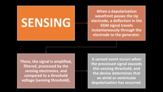 SENSING
When a depolarization
wavefront passes the tip
electrode, a deflection in the
EGM signal travels
instantaneously through the
electrode to the generator.
There, the signal is amplified,
filtered, processed by the
sensing electronics, and
compared to a threshold
voltage (sensing threshold).
A sensed event occurs when
the processed signal exceeds
this sensing threshold, and
the device determines that
an atrial or ventricular
depolarization has occurred.
 