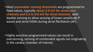 • Most pacemaker sensing thresholds are programmed to
fixed values, typically about 2.0 mV for ventricular
channels and 0.3 to 0.6 mV for atrial channels, with
bipolar sensing to allow sensing of lower-amplitude P
waves and atrial EGMs during atrial fibrillation (AF).
• Highly sensitive programmed values can result in
oversensing, sensing of unintended signals not originating
in the cardiac chamber of interest.
 