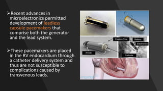 Recent advances in
microelectronics permitted
development of leadless
capsule pacemakers that
comprise both the generator
and the lead system.
These pacemakers are placed
in the RV endocardium through
a catheter delivery system and
thus are not susceptible to
complications caused by
transvenous leads.
 