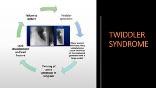 TWIDDLER
SYNDROME
Twiddler
syndrome:
Obese women
with loose, fatty
subcutaneous
tissue Small size
of the implanted
generator with a
large pocket
Twisting of
pulse
generator in
long axis
Lead
dislodgement
and lead
fracture
Failure to
capture
 