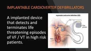 IMPLANTABLE CARDIOVERTER DEFIBRILLATORS
A implanted device
that detects and
terminates life
threatening episodes
of VF / VT in high risk
patients.
 