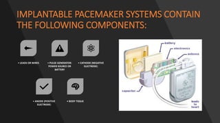 IMPLANTABLE PACEMAKER SYSTEMS CONTAIN
THE FOLLOWING COMPONENTS:
• LEADS OR WIRES • PULSE GENERATOR:
POWER SOURCE OR
BATTERY
• CATHODE (NEGATIVE
ELECTRODE)
• ANODE (POSITIVE
ELECTRODE)
• BODY TISSUE
 