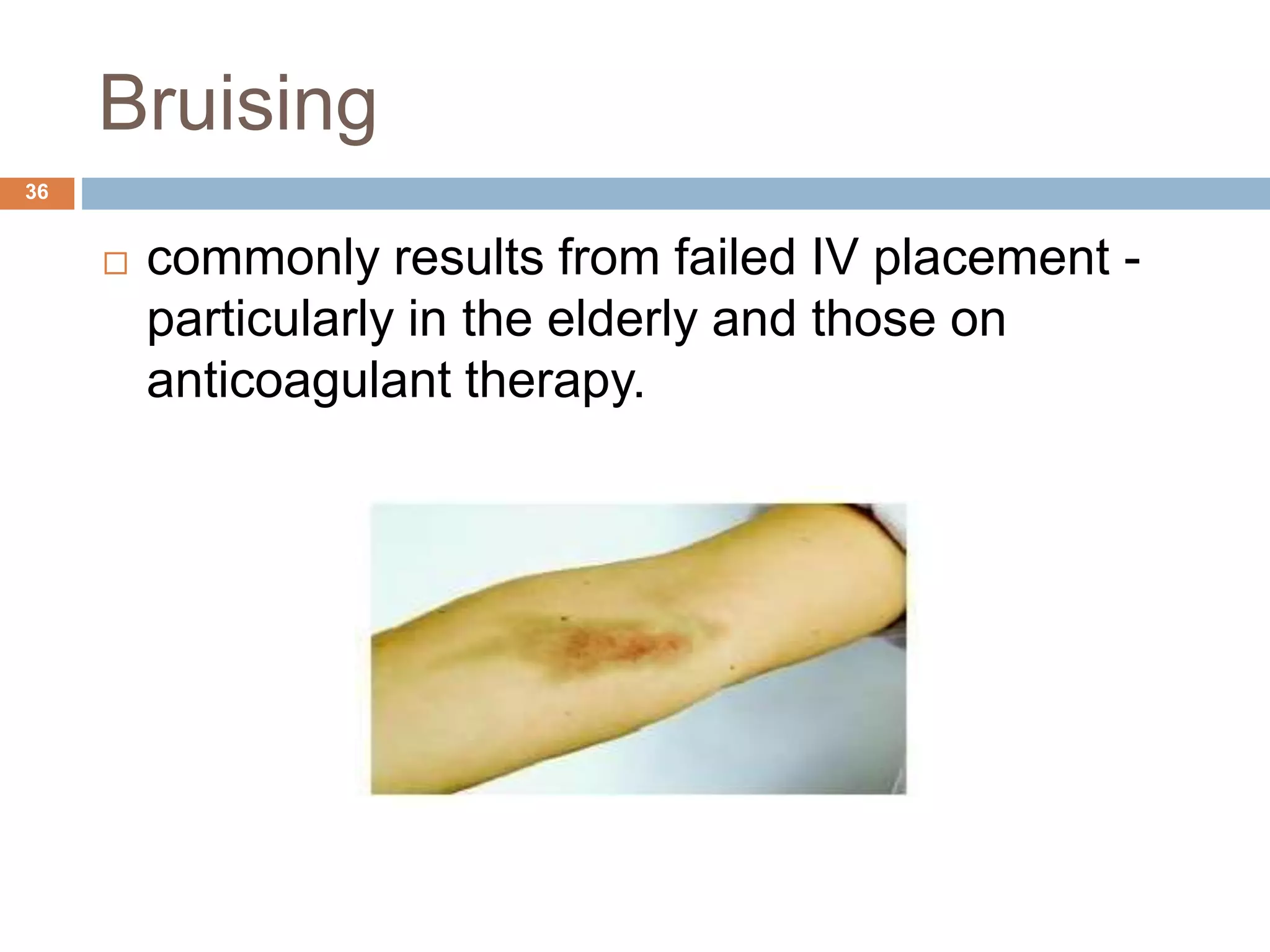 Intracatheters | PPTX