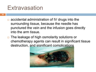 Extravasation
35
 accidental administration of IV drugs into the
surrounding tissue, because the needle has
punctured the vein and the infusion goes directly
into the arm tissue.
 The leakage of high osmolarity solutions or
chemotherapy agents can result in significant tissue
destruction, and significant complications
 