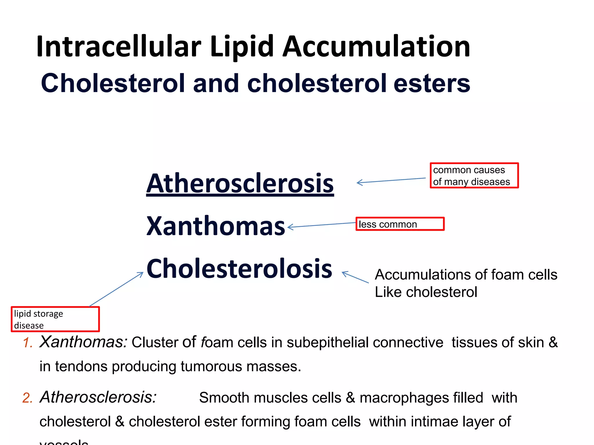Intracellular Lipid Accumulation
Cholesterol and cholesterol esters
Atherosclerosis
Xanthomas
Cholesterolosis
common causes
of many diseases
less common
lipid storage
disease
1. Xanthomas: Cluster of foam cells in subepithelial connective tissues of skin &
in tendons producing tumorous masses.
2. Atherosclerosis: Smooth muscles cells & macrophages filled with
cholesterol & cholesterol ester forming foam cells within intimae layer of
Accumulations of foam cells
Like cholesterol
 