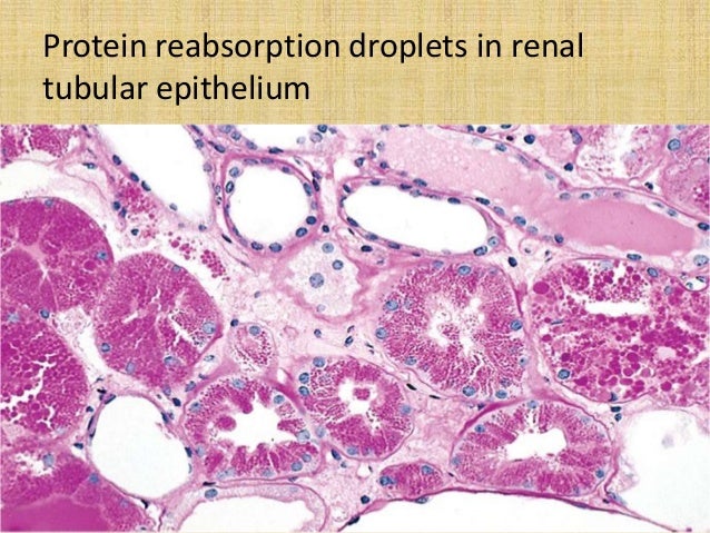 Intracellular accumulations ppt by dr usman nasir