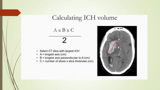 Intracerebral hemorrhage, SAH, ischemic stroke,[412].pptx
