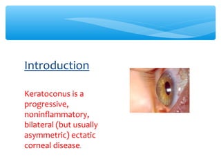 Keratoconus is a
progressive,
noninflammatory,
bilateral (but usually
asymmetric) ectatic
corneal disease.
Introduction
 