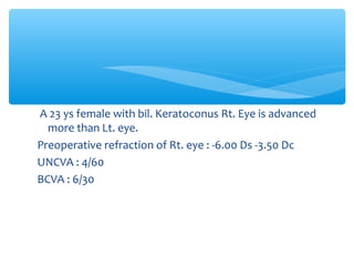 A 23 ys female with bil. Keratoconus Rt. Eye is advanced
more than Lt. eye.
Preoperative refraction of Rt. eye : -6.00 Ds -3.50 Dc
UNCVA : 4/60
BCVA : 6/30
 