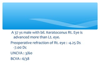 A 37 ys male with bil. Keratoconus Rt. Eye is
advanced more than Lt. eye.
Preoperative refraction of Rt. eye : -4.25 Ds
-7.00 Dc
UNCVA : 3/60
BCVA : 6/38
 