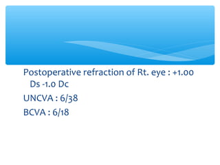 Postoperative refraction of Rt. eye : +1.00
Ds -1.0 Dc
UNCVA : 6/38
BCVA : 6/18
 