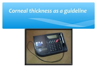 Corneal thickness as a guideline
 