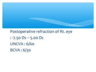 Postoperative refraction of Rt. eye
: -7.50 Ds – 5.00 Dc
UNCVA : 6/60
BCVA : 6/30
 