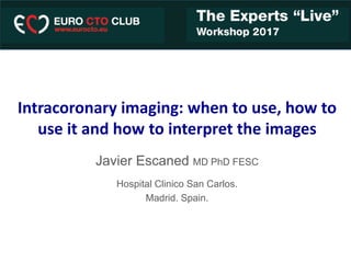 Intracoronary imaging: when to use, how to
use it and how to interpret the images
Javier Escaned MD PhD FESC
Hospital Clinico San Carlos.
Madrid. Spain.
 