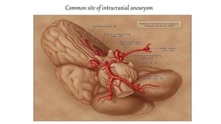 Common site of intracranial aneurysm
 