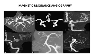 MAGNETIC RESONANCE ANGIOGRAPHY
 
