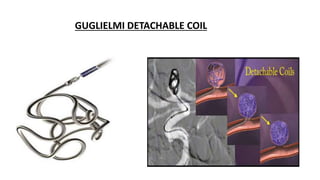 GUGLIELMI DETACHABLE COIL
 