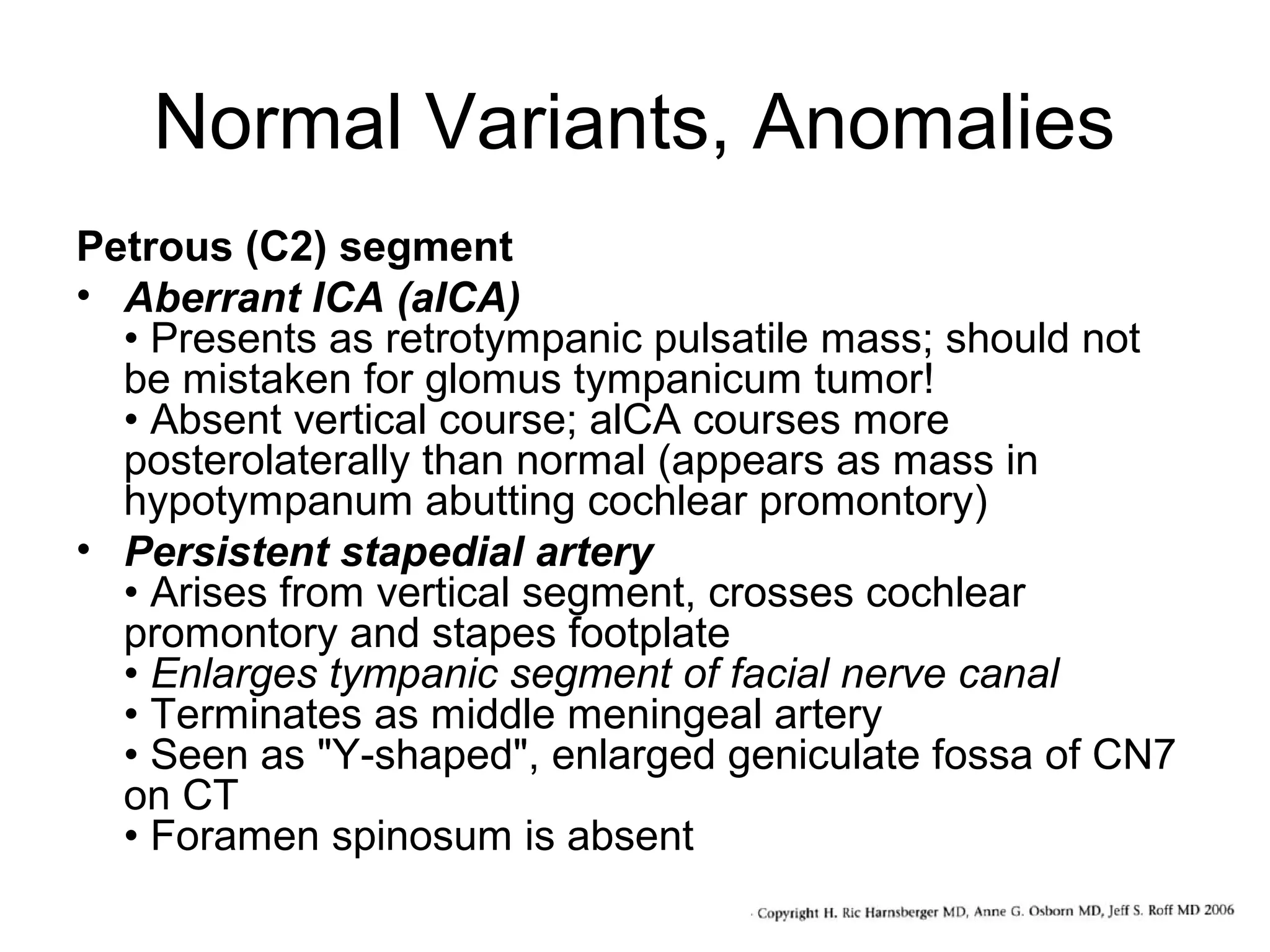 Normal Variants, Anomalies
Petrous (C2) segment
• Aberrant ICA (aICA)
• Presents as retrotympanic pulsatile mass; should not
be mistaken for glomus tympanicum tumor!
• Absent vertical course; alCA courses more
posterolaterally than normal (appears as mass in
hypotympanum abutting cochlear promontory)
• Persistent stapedial artery
• Arises from vertical segment, crosses cochlear
promontory and stapes footplate
• Enlarges tympanic segment of facial nerve canal
• Terminates as middle meningeal artery
• Seen as "Y-shaped", enlarged geniculate fossa of CN7
on CT
• Foramen spinosum is absent

 