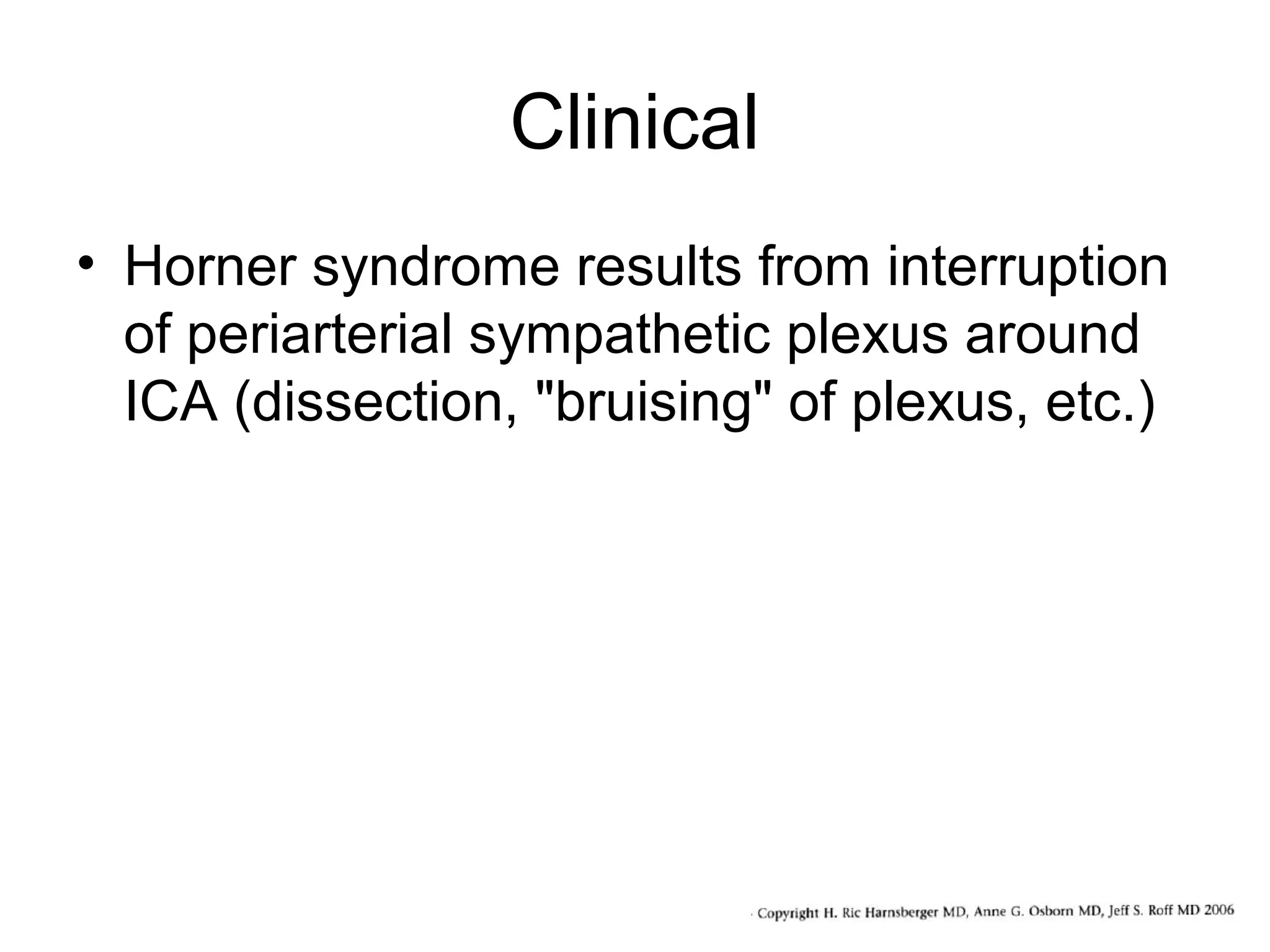 Clinical
• Horner syndrome results from interruption
of periarterial sympathetic plexus around
ICA (dissection, "bruising" of plexus, etc.)

 