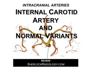INTRACRANIAL ARTERIES

INTERNAL CAROTID
ARTERY
AND
NORMAL VARIANTS

REVIEW

SHERLOCKRADIOLOGY.COM

 