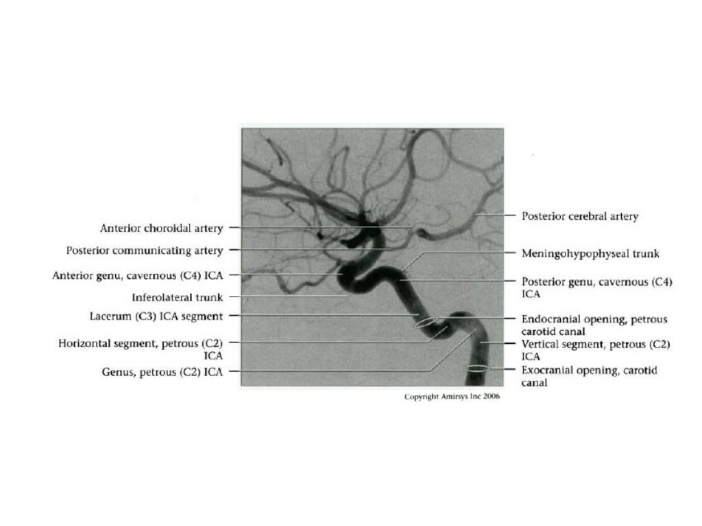 Internal Carotid Artery and Normal Variants