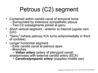Petrous (C2) segment
• Contained within carotid canal of temporal bone
- Surrounded by extensive sympathetic plexus
- Two C2 subsegments joined at genu
• Short vertical segment - anterior to internal jugular vein
(lJV)
• "Genu" (where petrous ICA turns anteromedially in front
of cochlea)
• Longer horizontal segment
- Exits carotid canal at petrous apex
- Branches
• Vidian artery (artery of pterygoid canal)
anastomoses with external carotid artery (ECA)
• Caroticotympanic artery (supplies middle ear)

 