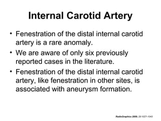 Internal Carotid Artery
• Fenestration of the distal internal carotid
artery is a rare anomaly.
• We are aware of only six previously
reported cases in the literature.
• Fenestration of the distal internal carotid
artery, like fenestration in other sites, is
associated with aneurysm formation.

RadioGraphics 2009; 29:1027–1043

 