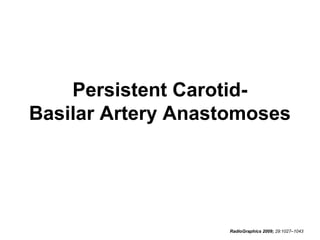 Persistent CarotidBasilar Artery Anastomoses

RadioGraphics 2009; 29:1027–1043

 