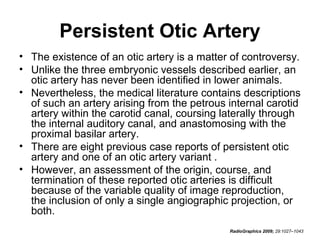 Persistent Otic Artery
• The existence of an otic artery is a matter of controversy.
• Unlike the three embryonic vessels described earlier, an
otic artery has never been identified in lower animals.
• Nevertheless, the medical literature contains descriptions
of such an artery arising from the petrous internal carotid
artery within the carotid canal, coursing laterally through
the internal auditory canal, and anastomosing with the
proximal basilar artery.
• There are eight previous case reports of persistent otic
artery and one of an otic artery variant .
• However, an assessment of the origin, course, and
termination of these reported otic arteries is difficult
because of the variable quality of image reproduction,
the inclusion of only a single angiographic projection, or
both.
RadioGraphics 2009; 29:1027–1043

 