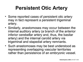 Persistent Otic Artery
• Some reported cases of persistent otic artery
may in fact represent a persistent trigeminal
artery.
• Similarly, anastomoses may occur between the
internal auditory artery (a branch of the anterior
inferior cerebellar artery and, thus, the basilar
artery) and the internal carotid artery via
trigeminal and stapedial artery remnants.
• Such anastomoses may be best understood as
representing overlapping vascular territories
rather than persistence of an embryonic vessel.
RadioGraphics 2009; 29:1027–1043

 