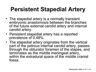 Persistent Stapedial Artery
• The stapedial artery is a normally transient
embryonic anastomosis between the branches
of the future external carotid artery and internal
carotid artery.
• Persistent stapedial artery has a reported
prevalence of 0.48%.
• The stapedial artery originates from the vertical
part of the petrous internal carotid artery, passes
through the obturator foramen of the stapes, and
terminates as the middle meningeal artery,
within the extradural space of the middle cranial
fossa.
RadioGraphics 2009; 29:1027–1043

 