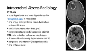 Intracranial and Cranial Complications of Sinusitis: Diagnosis and ...