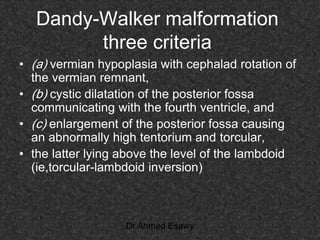 Torcular Inversion Intracranial congenital cystic lesion Dr Ahmed Esawy CT MRI part 2 | PDF