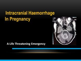 Intracranial Haemorrhage
In Pregnancy
A Life Threatening Emergency
 