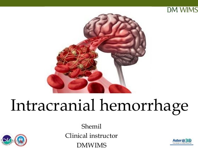 Types Of Intracranial Hemorrhage