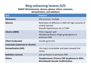 Ring enhancing lesions D/D
MAGIC DR (metastasis, abscess, glioma, infarct, contusion,
demyelination, and radiation)
D/D Features
Metastasis GW junction; multiple
Abscess Restriction of diffusion in DWI d/t high viscocity of
central necrosis
Smooth hypointense rim in T2WI
Glioma (GBM) Thick irregular wall
Elevated perfusion inhigh grade glioma in
perfusion MRI
Infarct (subacute) Usually gyral enh;
Costusioin (subacute to chronic)
Demyelination (MS) the ring is incomplete and open towards the
cortex
Radiation necrosis Low perfusion in perfusion MRI
Others Toxoplasmosis; Primary CNS lymphoma in AIDS ;
thrombosed vascular malformation
 