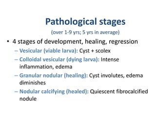 Pathological stages
(over 1-9 yrs; 5 yrs in average)
• 4 stages of development, healing, regression
– Vesicular (viable larva): Cyst + scolex
– Colloidal vesicular (dying larva): Intense
inflammation, edema
– Granular nodular (healing): Cyst involutes, edema
diminishes
– Nodular calcifying (healed): Quiescent fibrocalcified
nodule
 