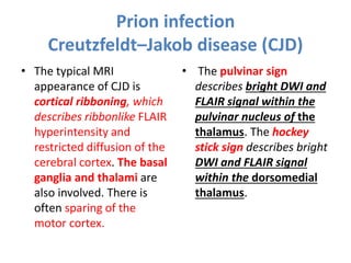 Prion infection
Creutzfeldt–Jakob disease (CJD)
• The typical MRI
appearance of CJD is
cortical ribboning, which
describes ribbonlike FLAIR
hyperintensity and
restricted diffusion of the
cerebral cortex. The basal
ganglia and thalami are
also involved. There is
often sparing of the
motor cortex.
• The pulvinar sign
describes bright DWI and
FLAIR signal within the
pulvinar nucleus of the
thalamus. The hockey
stick sign describes bright
DWI and FLAIR signal
within the dorsomedial
thalamus.
 