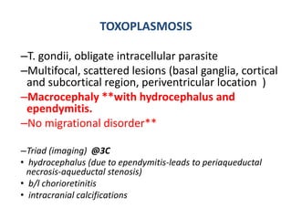TOXOPLASMOSIS
–T. gondii, obligate intracellular parasite
–Multifocal, scattered lesions (basal ganglia, cortical
and subcortical region, periventricular location )
–Macrocephaly **with hydrocephalus and
ependymitis.
–No migrational disorder**
–Triad (imaging) @3C
• hydrocephalus (due to ependymitis-leads to periaqueductal
necrosis-aqueductal stenosis)
• b/l chorioretinitis
• intracranial calcifications
 