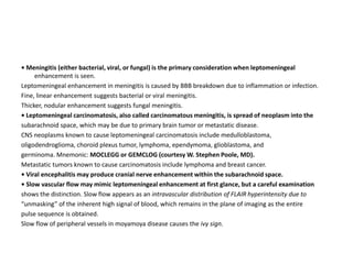 • Meningitis (either bacterial, viral, or fungal) is the primary consideration when leptomeningeal
enhancement is seen.
Leptomeningeal enhancement in meningitis is caused by BBB breakdown due to inflammation or infection.
Fine, linear enhancement suggests bacterial or viral meningitis.
Thicker, nodular enhancement suggests fungal meningitis.
• Leptomeningeal carcinomatosis, also called carcinomatous meningitis, is spread of neoplasm into the
subarachnoid space, which may be due to primary brain tumor or metastatic disease.
CNS neoplasms known to cause leptomeningeal carcinomatosis include medulloblastoma,
oligodendroglioma, choroid plexus tumor, lymphoma, ependymoma, glioblastoma, and
germinoma. Mnemonic: MOCLEGG or GEMCLOG (courtesy W. Stephen Poole, MD).
Metastatic tumors known to cause carcinomatosis include lymphoma and breast cancer.
• Viral encephalitis may produce cranial nerve enhancement within the subarachnoid space.
• Slow vascular flow may mimic leptomeningeal enhancement at first glance, but a careful examination
shows the distinction. Slow flow appears as an intravascular distribution of FLAIR hyperintensity due to
“unmasking” of the inherent high signal of blood, which remains in the plane of imaging as the entire
pulse sequence is obtained.
Slow flow of peripheral vessels in moyamoya disease causes the ivy sign.
 